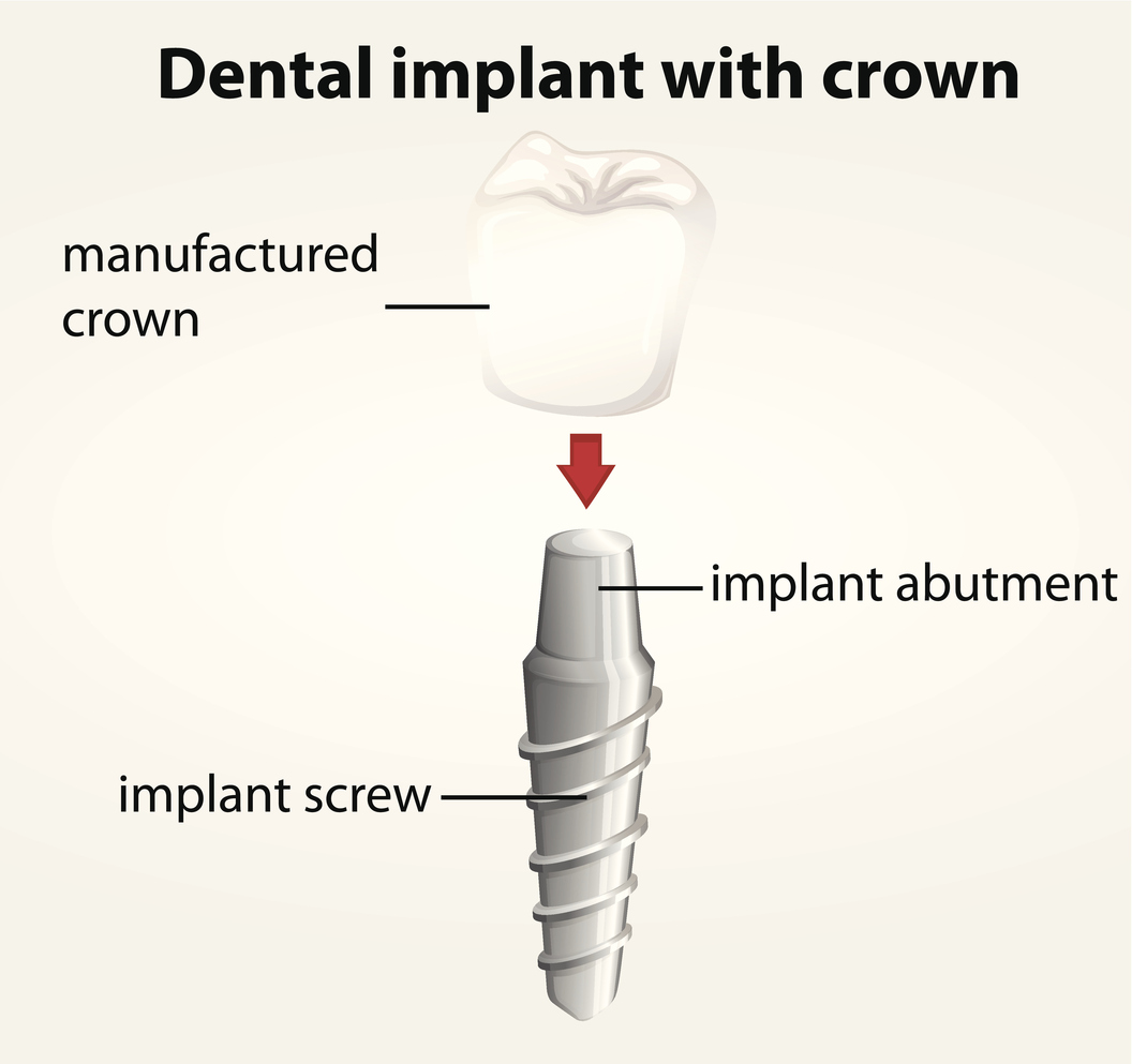 Dental Pain