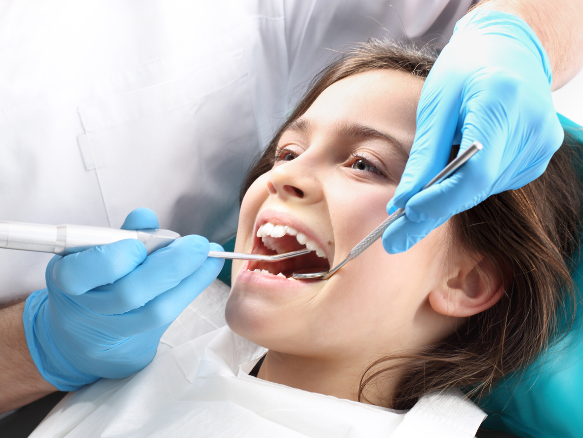 dental-Sealants-in-kids