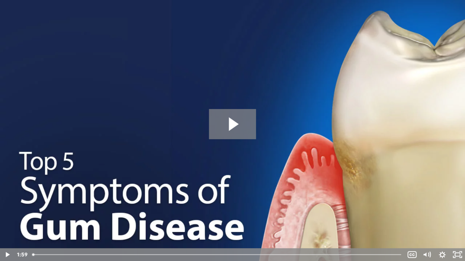 How To Say Gum Disease